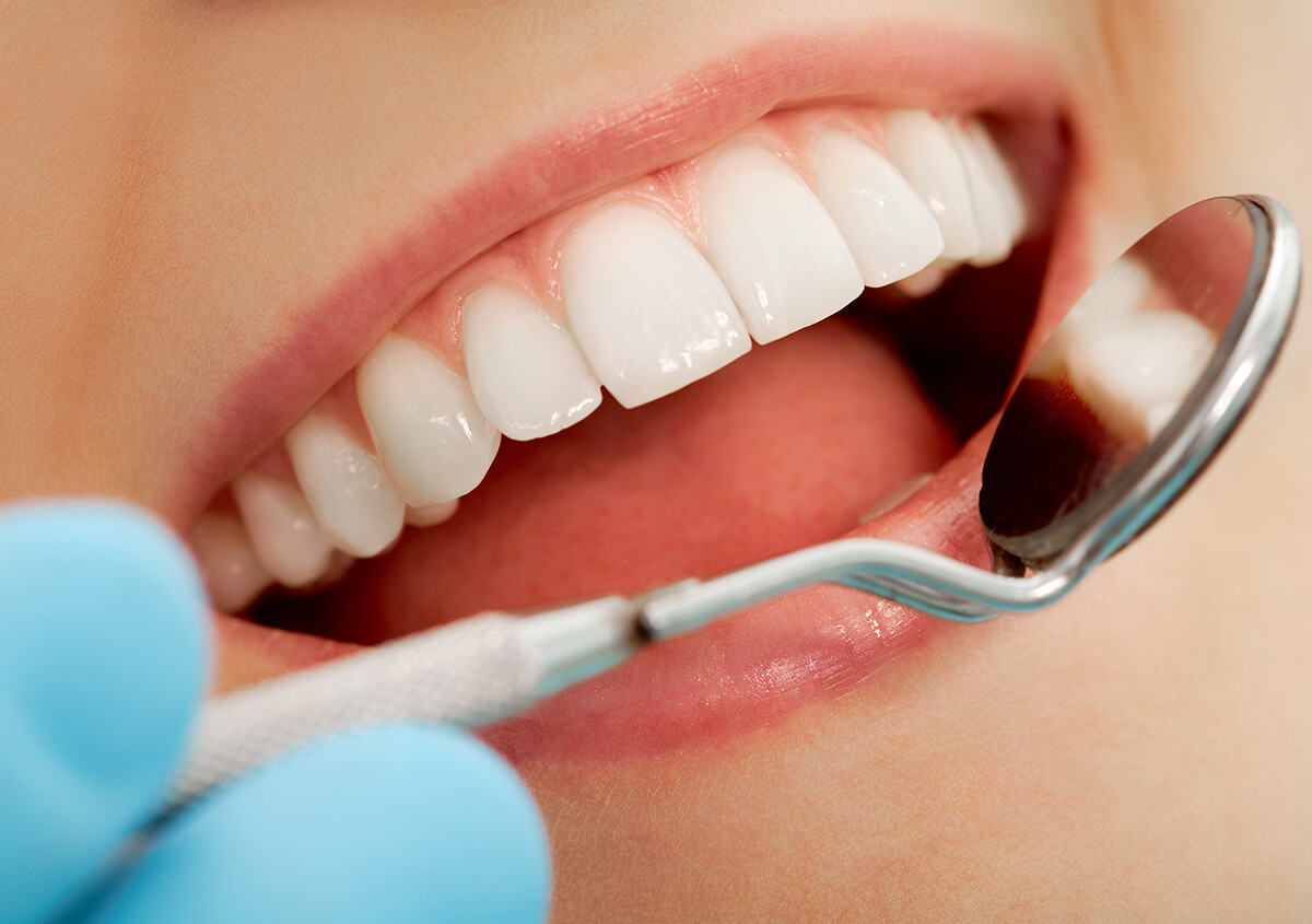 Are Dental Veneers a Better Option for You?